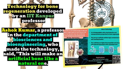 IIT Professor Develops Revolutionary Bone-Regeneration Technology